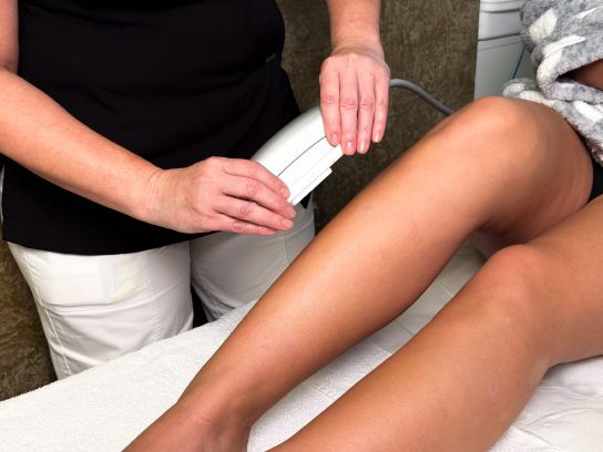 IMG_2909 IPL  epilace nebo rejuvenace.