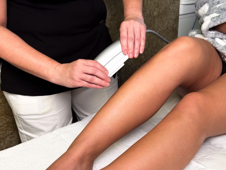 IMG_2909 IPL  epilace nebo rejuvenace.