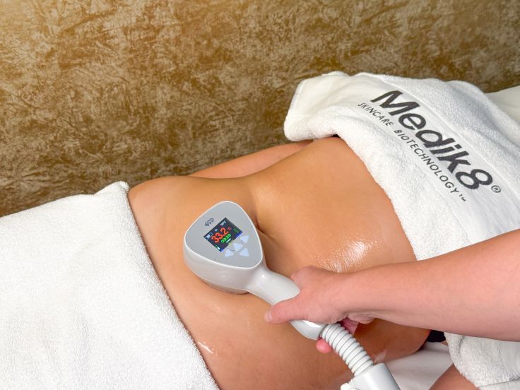 IMG_2895 Radiofrekvence - hubnutí